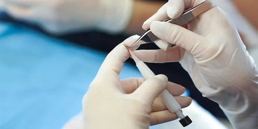 Kayseri DHI Saç Ekimi